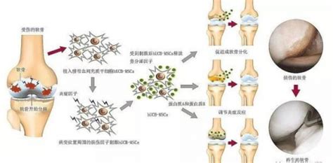 朱德湘|风湿与骨关节病治疗新突破